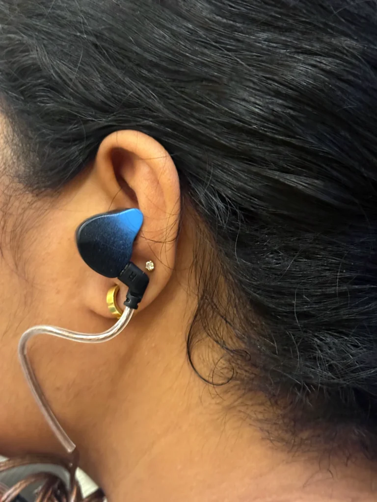 Kiwi Ears Dolce Review